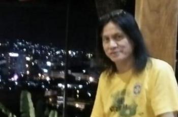 Musisi Senior Jimmie Manopo Jalani Operasi, Kaki Kanan Diamputasi