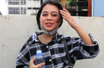 Cimoy Montok Ungkap Alasan Buka Tutup Hijab, Sepi Job?