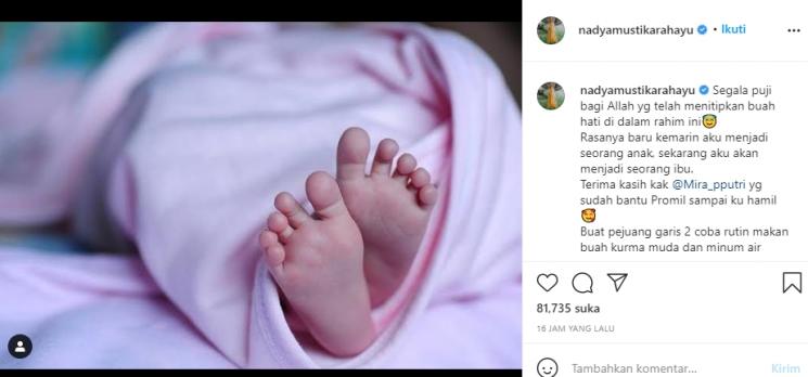 Nadya Mustika Rahayu (Instagram/@nadyamustikarahayu)