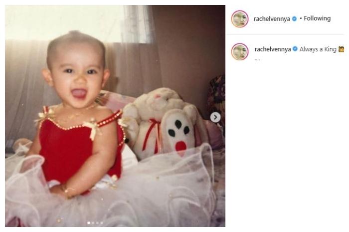 Potret masa kecil Rachel Vennya. (Instagram/@rachelvennya)