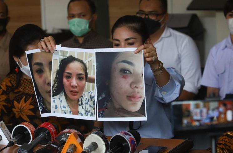 Penyanyi Nindy Ayunda saat menggelar konferensi pers terkait dugaan KDRT yang diterimanya daei sang suami, Askara Parasady Harsono di Kantor Komnas Perempuan, Jakarta Pusat, Selasa (16/2/2021). [Matamata.com/Alfian Winanto]