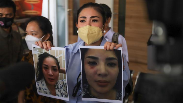 Penyanyi Nindy Ayunda saat menggelar konferensi pers terkait dugaan KDRT yang diterimanya daei sang suami, Askara Parasady Harsono di Kantor Komnas Perempuan, Jakarta Pusat, Selasa (16/2/2021). [Matamata.com/Alfian Winanto]