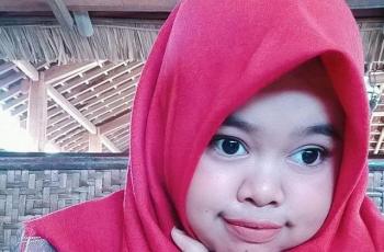 Kekeyi Filler Hidung agar Terlihat Mancung Disorot: Miring Key!