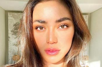 Jessica Iskandar Divonis Autoimun, Begini Kondisinya Sekarang!