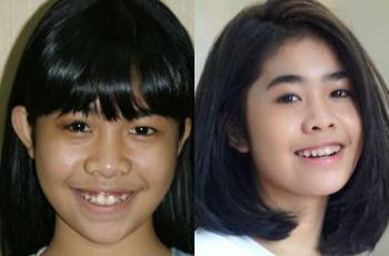 Sudah Remaja, Intip 5 Potret Alifa Lubis yang Glow Up Abis!