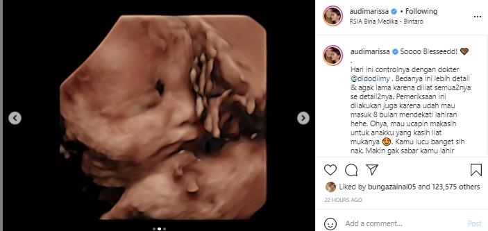 Postingan Audi Marissa (Instagram.com)