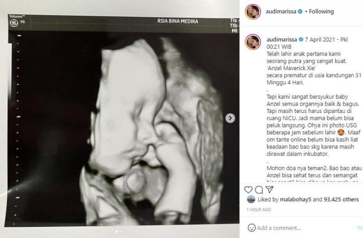 Audi Marissa melahirkan anak pertama. (Instagram/@audimarissa)
