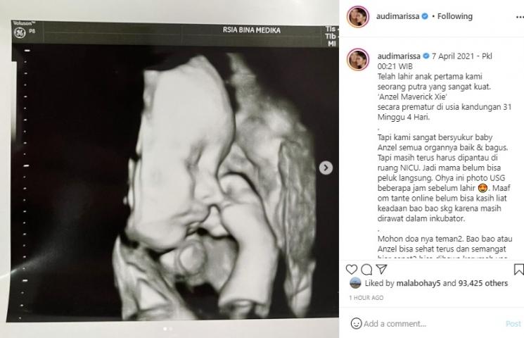 Audi Marissa melahirkan anak pertama. (Instagram/@audimarissa)