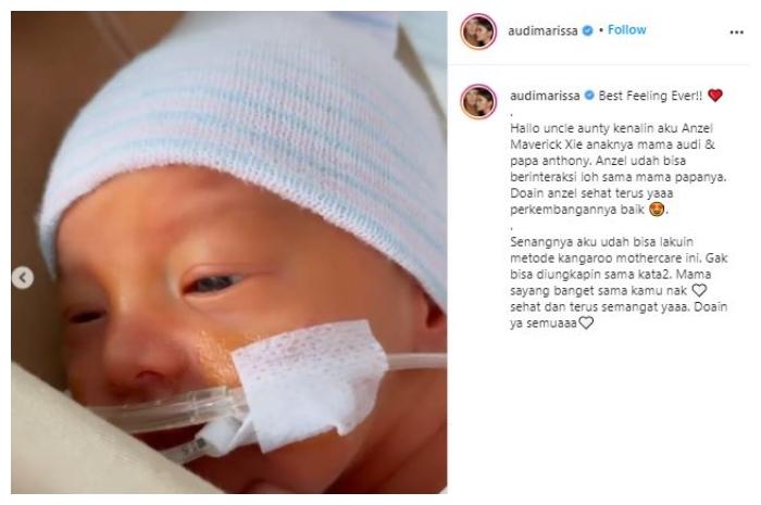 Wajah bayi Audi Marissa. (Instagram/@audimarissa)
