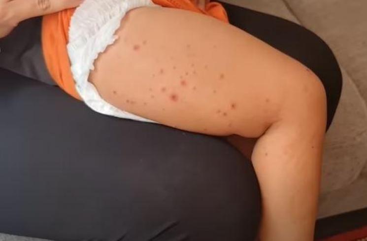 Kiano Tiger Wong positif flu Singapura. (Youtube/BaimPaula)