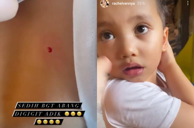 Xabiru, anak Rachel Vennya (Instagram/@rachelvennya)
