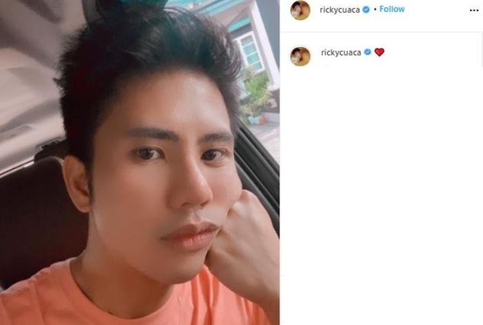 Ricky Cuaca operasi hidung. (Instagram/@rickycuaca)