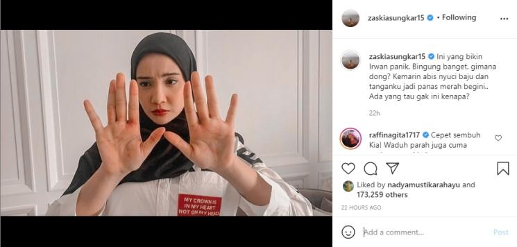Irwansyah Panik Tangan Zaskia Sungkar Panas dan Merah. (Instagram/zaskiasungkar15)