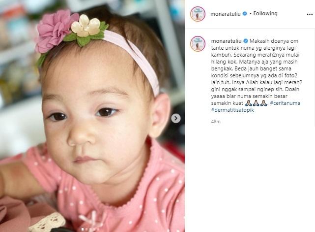 Anak Mona Ratuliu alergi makan telur. (Instagram/@monaratuliu)