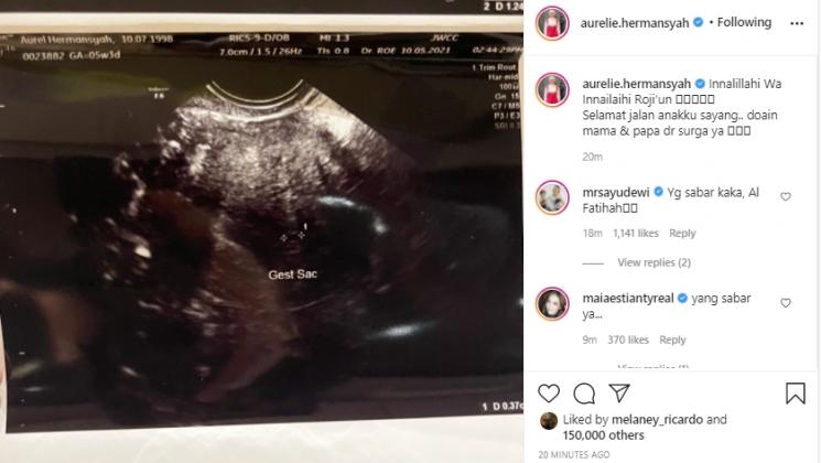 Postingan Aurel Hermansyah (Instagram.com)