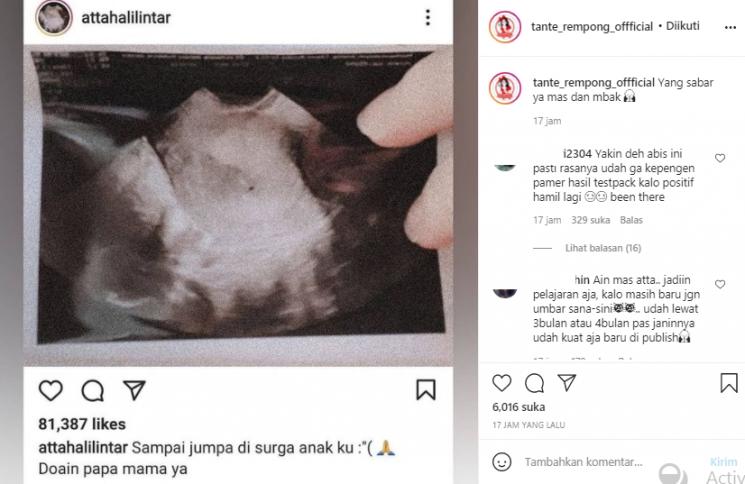 Aurel Hermansyah dicibir usai keguguran (Instagram.com)
