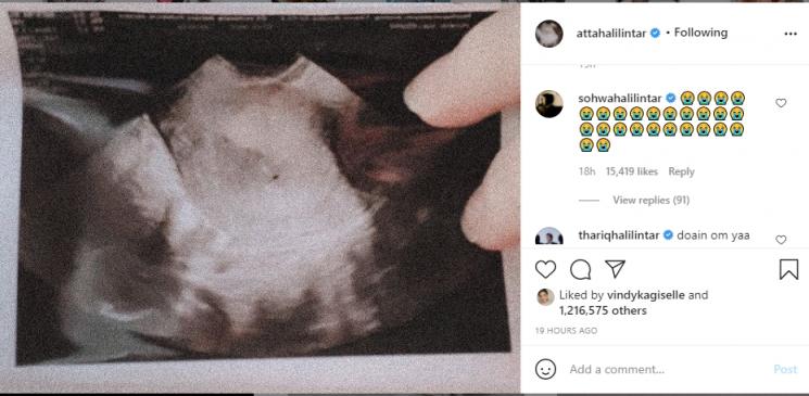 Aurel Hermansyah keguguran, adik Atta Halilintar ikut bersedih. (Instagram/attahalilintar)