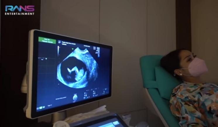 Nagita Slavina periksa ke dokter kandungan (Youtube.com)