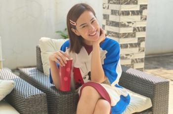 Foto Lama Tersebar, Astrid Tiar Ramai Dituding Operasi Plastik