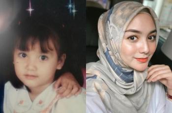 8 Potret Transformasi Citra Kirana: Fix Cantik dari Lahir!