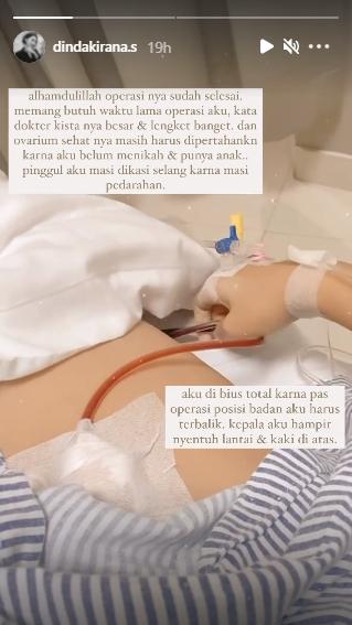 Dinda Kirana bagikan kondisi pasca operasi (Instagram.com)