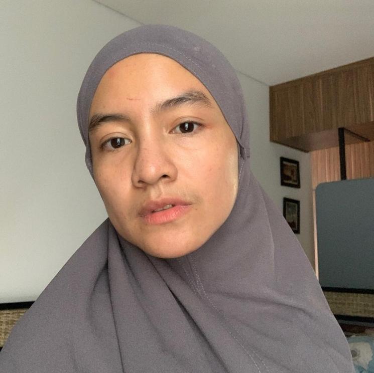 Potret Terbaru Intan Nuraini (Instagram/@intan_nuraini23)