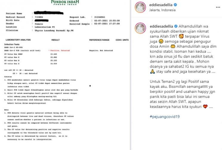 Eddies Adelia positif Covid-19 (Instagram/@eddiesadellia)