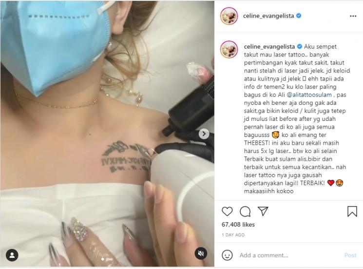 Potret Celine Evangelista Hapus Tato (Instagram/@celine_evangelista)