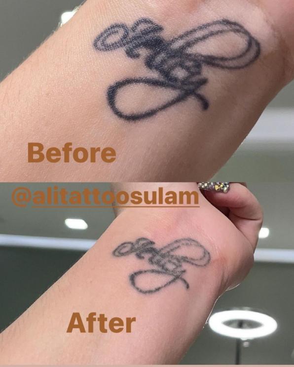 Potret Celine Evangelista Hapus Tato (Instagram/@celine_evangelista)