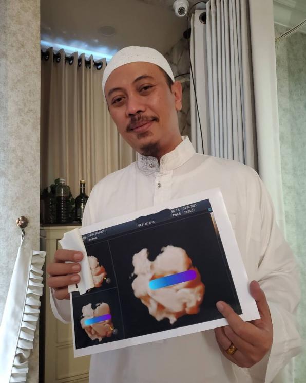 Potret Kemesraan Opick Dan Bebi Silvana. (Instagram/bebi.silvana)
