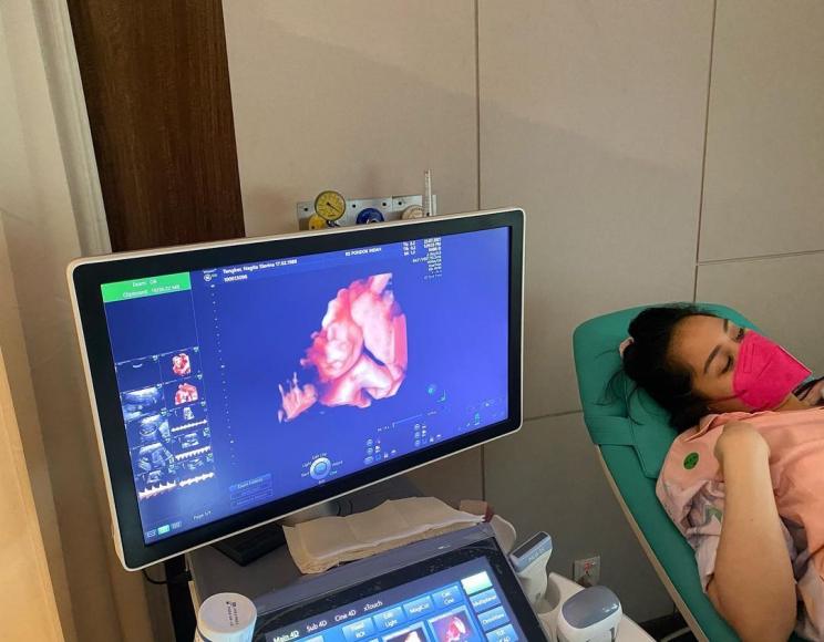 Raffi Ahmad tunjukkan hasil USG kehamilan Nagita Slavina (Instagram/@raffinagita1717)