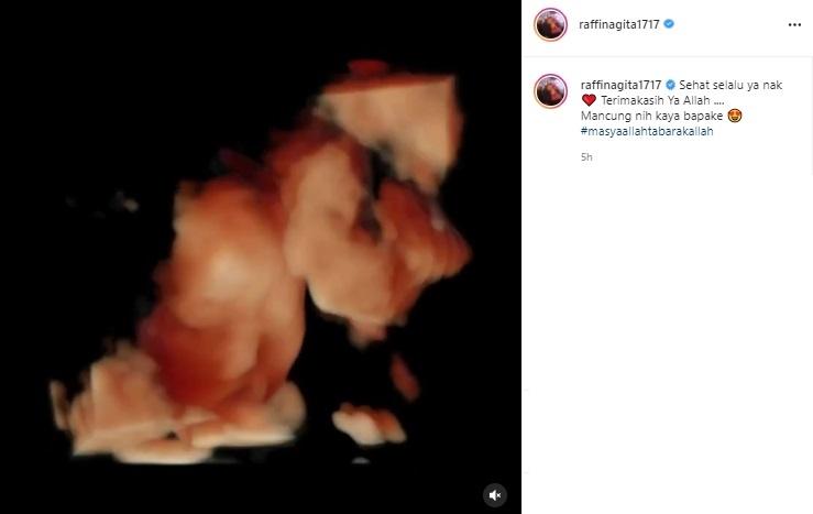 Raffi Ahmad tunjukkan hasil USG kehamilan Nagita Slavina (Instagram/@raffinagita1717)