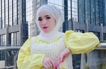 7 Fakta Herlin Kenza, Selebgram Asal Aceh yang Dijuluki Barbie!