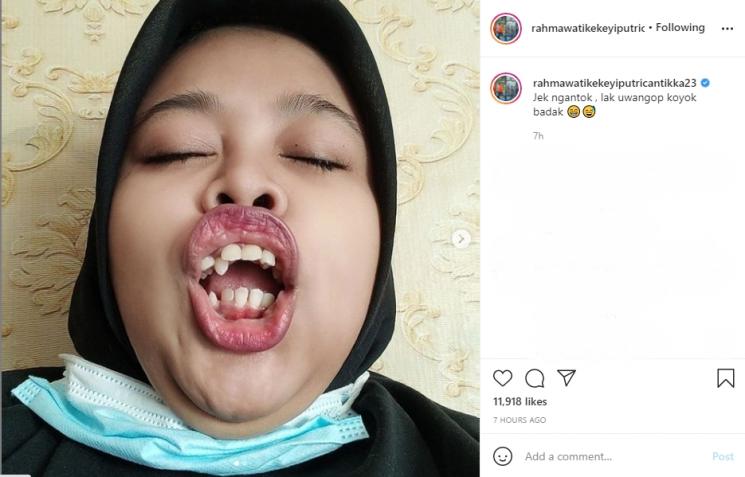 Kekeyi pamer pose menguap. (Instagram/rahmawatikekeyiputricantikka23)
