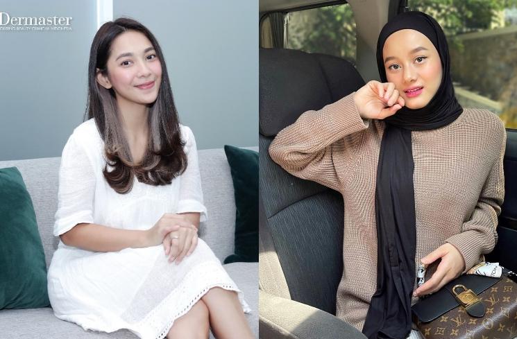 Adu Pesona Artis Bernama Dinda. (Instagram/dindakirana.s/dindahw)