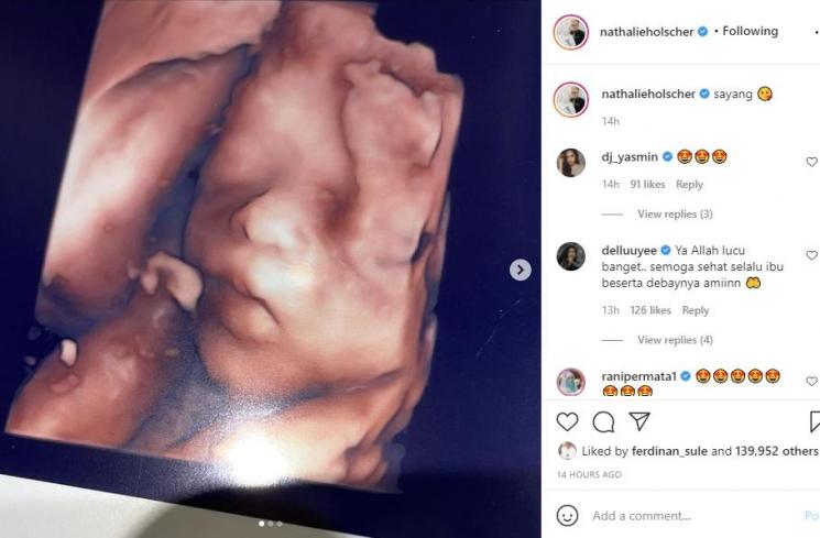 Nathalie Holscher memperlihatkan USG calon buah hatinya. (Instagram/nathalieholscher)