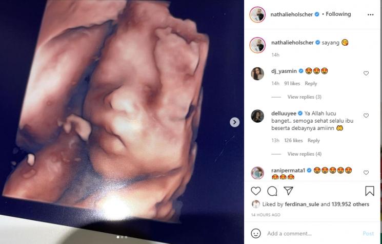 Nathalie Holscher memperlihatkan USG calon buah hatinya. (Instagram/nathalieholscher)