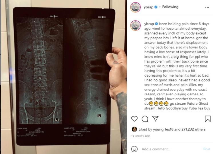 Reza Arap sakit tulang belakang. (Instagram/ybrap)