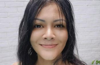 Baru Jalani Operasi, Manajer Ungkap Penyakit yang Diidap Melanie Subono