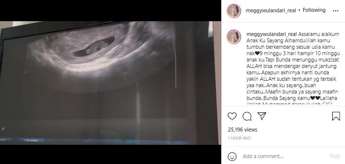 Meggy Wulandari tunjukan USG janin yang dikandungnya (instagram.com)