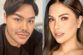 Miliki Tampilan Menawan, Ini 6 Artis yang Blak-Blakan Mengaku Oplas