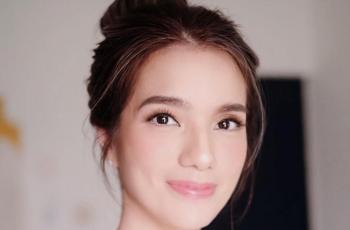 Mata Sheila Marcia Mendadak Lebam, Penyebabnya Bikin Ngilu!