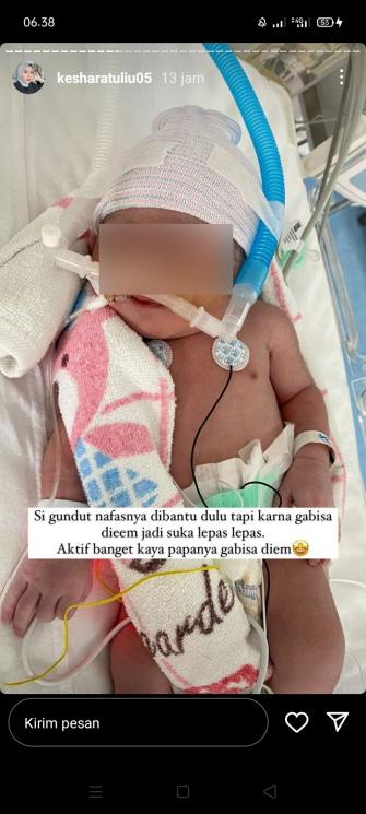 Potret Kesha Ratuliu Melahirkan. (Instagram/keshasatuliu05)