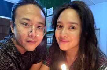 Wajah Berubah Drastis sampai Dikira Operasi Plastik, Dea Ananda Bongkar Faktanya