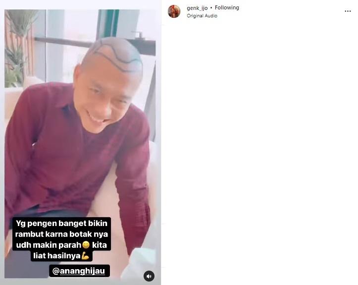 Anang Hermansyah botak. (Instagram)