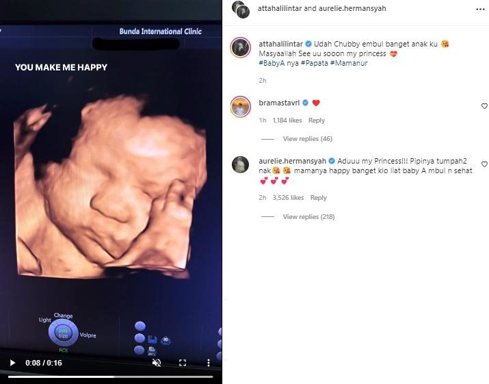 Potret terbaru calon bayi Atta Halilintar. (Instagram/@attahalilintar)