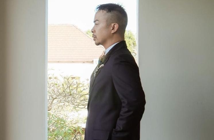 Potret Dave Hendrik Usai Transplantasi Rambut (instagram/@davehendrik)