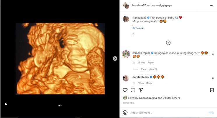 Franda dan Samuel Zylgwyn memperlihatkan potret USG anak kedua. (Instagram/frandaaa87)