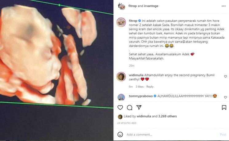Fitri Tropica memperlihatkan potret USG anak kedua. (Instagram/fitrop)