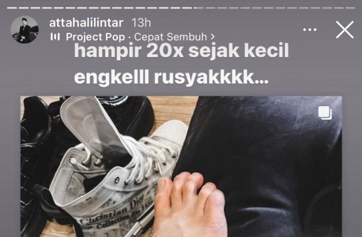 Atta Halilintar cedera engkel. (Instagram/attahalilintar)